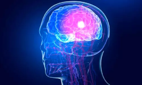 അത്യപൂർവമായ ജനിതക രോഗം ‘സ്യൂഡോ ടോർച്ച് സിൻഡ്രം’ ബംഗളൂരുവിൽ പെൺകുട്ടിക്ക്; ഇന്ത്യയിലാദ്യം, ലോകത്ത് ക​ണ്ടെത്തിയത് 12 പേരിൽ മാത്രം