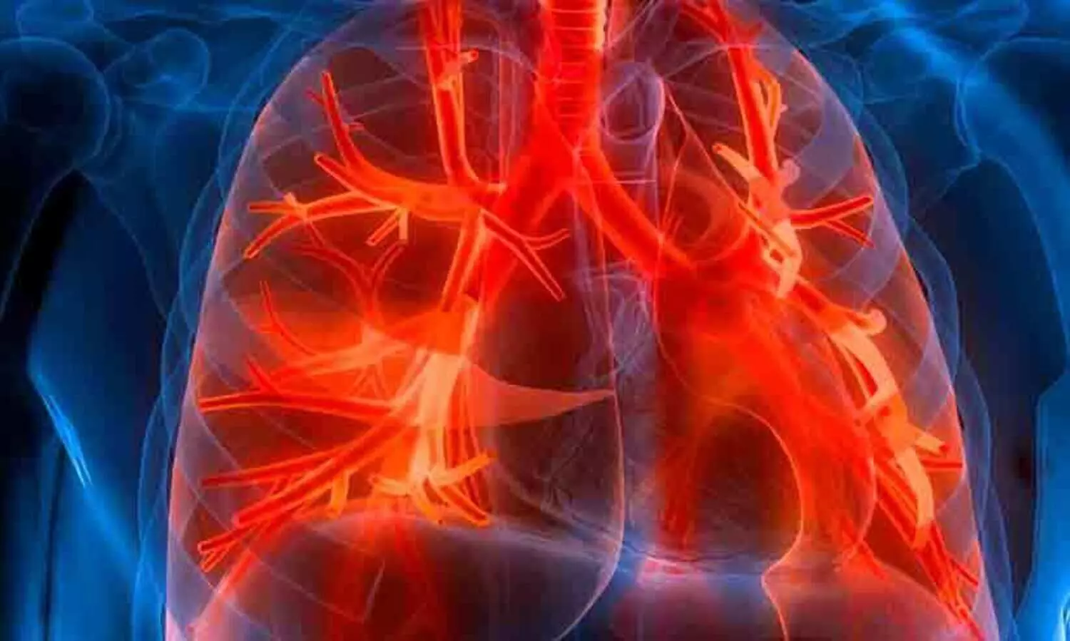 2025 ൽ ക്ഷയരോഗം നിർമാർജനം ചെയ്യുമെന്ന ഇന്ത്യയുടെ പ്രഖ്യാപനം എങ്ങുമെത്തിയില്ല; കണക്കുകൾ പുറത്തുവിടാതെ ആരോഗ്യ മന്ത്രാലയം