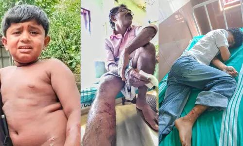 തെരുവുനായുടെ ആക്രമണത്തിൽ പിഞ്ചുകുഞ്ഞിനടക്കം നിരവധിപേർക്ക് പരിക്ക്