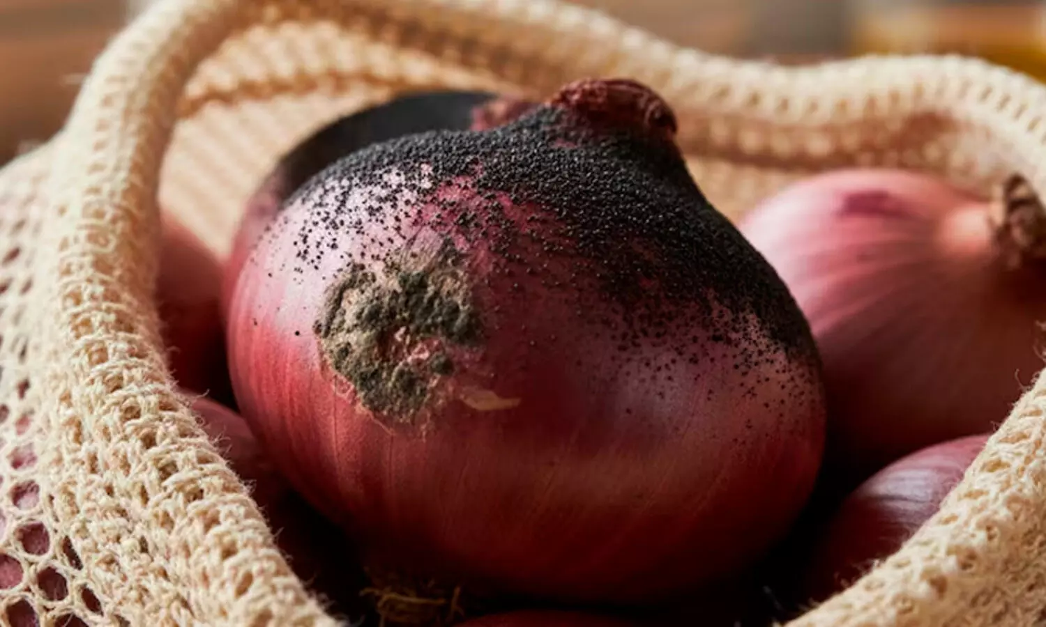 കറുത്ത പാടുകളുള്ള സവാള ഉപയോഗിച്ചാൽ ആരോഗ്യപ്ര​ശ്നമുണ്ടാകുമോ?