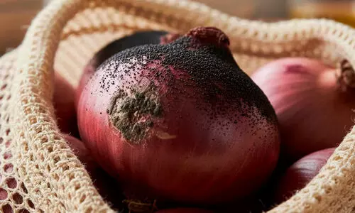 കറുത്ത പാടുകളുള്ള സവാള ഉപയോഗിച്ചാൽ ആരോഗ്യപ്ര​ശ്നമുണ്ടാകുമോ?