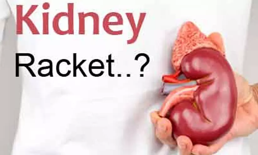 Representation Image Representation Image