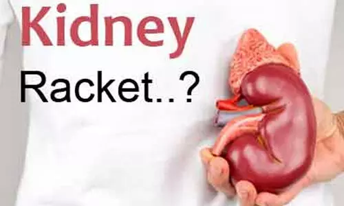 Representation Image