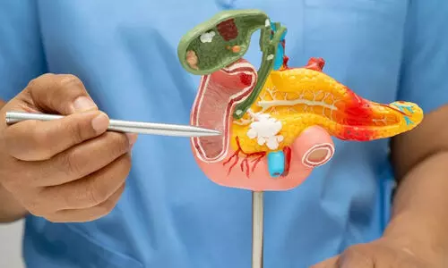 പ്രായമായവരിൽ പാൻക്രിയാറ്റിക് കാൻസറിനുള്ള സാധ്യത കൂടുതൽ; എന്തൊക്കെ കഴിക്കാം, ഒഴിവാക്കാം?