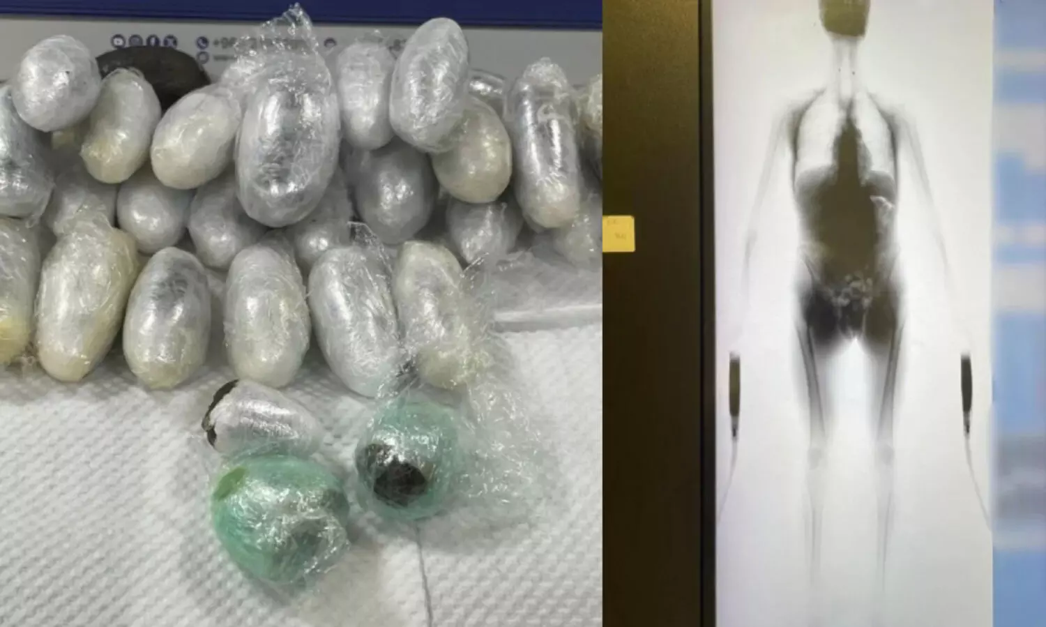 ശരീരത്തിൽ ഒളിപ്പിച്ച് ലഹരി കടത്താൻ ശ്രമം; വിമാനത്താവളത്തിൽ യൂറോപ്യൻ പൗരൻ പിടിയിൽ