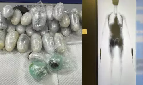 ശരീരത്തിൽ ഒളിപ്പിച്ച് ലഹരി കടത്താൻ ശ്രമം; വിമാനത്താവളത്തിൽ യൂറോപ്യൻ പൗരൻ പിടിയിൽ