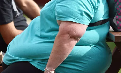 WHO issues guidelines for using novel weight loss drugs to combat obesity WHO issues guidelines for using novel weight loss drugs to combat obesity