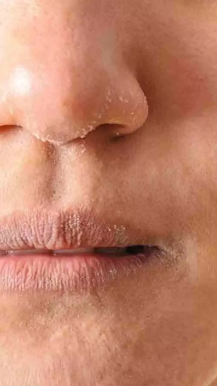 തണുപ്പു കാലത്ത് ചർമം സംരക്ഷിക്കാൻ ഈ വഴികൾ പരീക്ഷിക്കാം