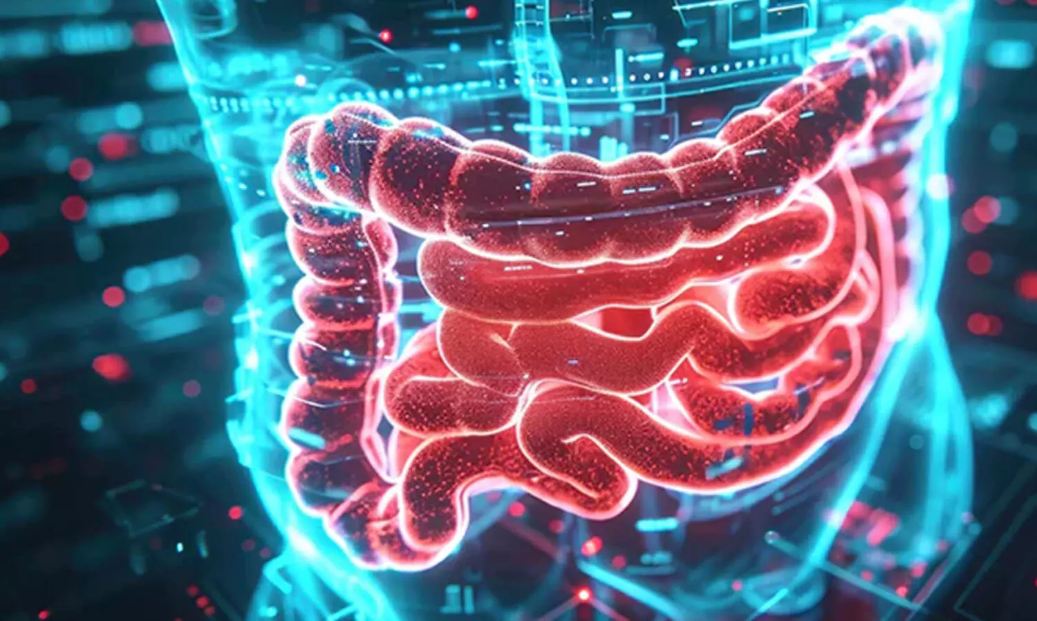 കുടലിലെ ബാക്ടീരിയ അസന്തുലിതാവസ്ഥ ബുദ്ധിയെ ബാധിക്കുമെന്ന് പഠനം