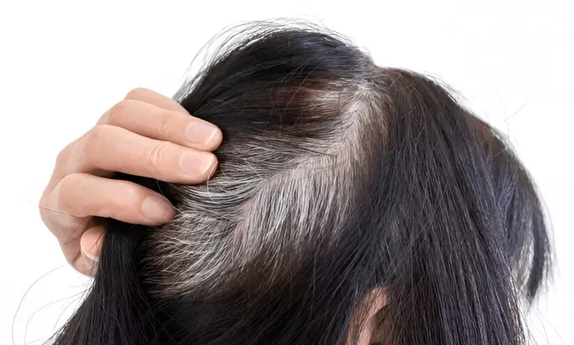 white hair white hair