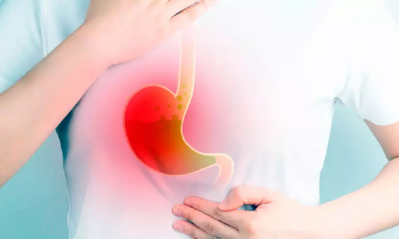 Representation image Representation image