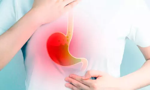 Representation image