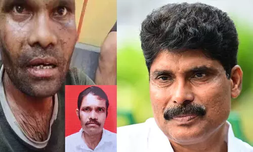 മരണത്തെ മുഖാമുഖം കാണുമ്പോഴും ജീവന് വേണ്ടി നിസഹായതയോടെയുള്ള ചിരിയുണ്ട്, അത് മനസ്സിൽ നിന്നും മായുന്നില്ല; ആ 10 ലക്ഷം മതിയാകില്ല, മുഖ്യമന്ത്രിക്ക് കത്തെഴുതി ടി.സിദ്ധീഖ് എം.എൽ.എ