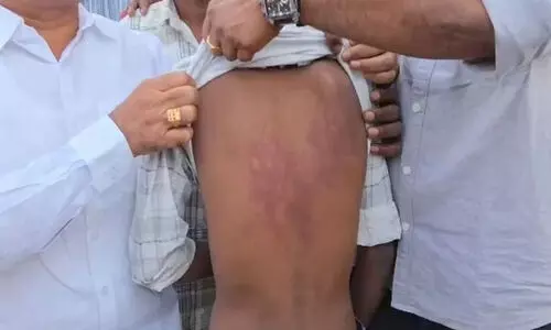 സൈക്കിളിന്‍റെ കാറ്റഴിച്ച് വിട്ടെന്ന് ആരോപണം; പ്രിൻസിപ്പലിന്റെ നിർദ്ദേശപ്രകാരം ഏഴാം ക്ലാസ് വിദ്യാർഥിയെ പത്താം ക്ലാസ് വിദ്യാർഥികൾ ക്രൂരമായി തല്ലിച്ചതച്ചു