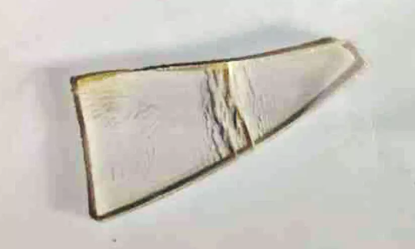 മെഡിക്കല്‍ കോളജ് ആശുപത്രിയില്‍ ശസ്ത്രക്രിയ പിഴവ്; യുവാവിന്‍റെ കാലില്‍ തുന്നിക്കെട്ടിയ മുറിവില്‍നിന്ന് ചില്ല് നീക്കം ചെയ്തു