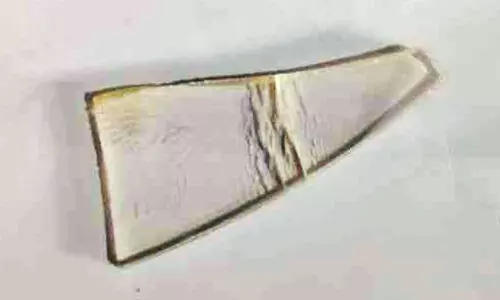 മെഡിക്കല്‍ കോളജ് ആശുപത്രിയില്‍ ശസ്ത്രക്രിയ പിഴവ്; യുവാവിന്‍റെ കാലില്‍ തുന്നിക്കെട്ടിയ മുറിവില്‍നിന്ന് ചില്ല് നീക്കം ചെയ്തു