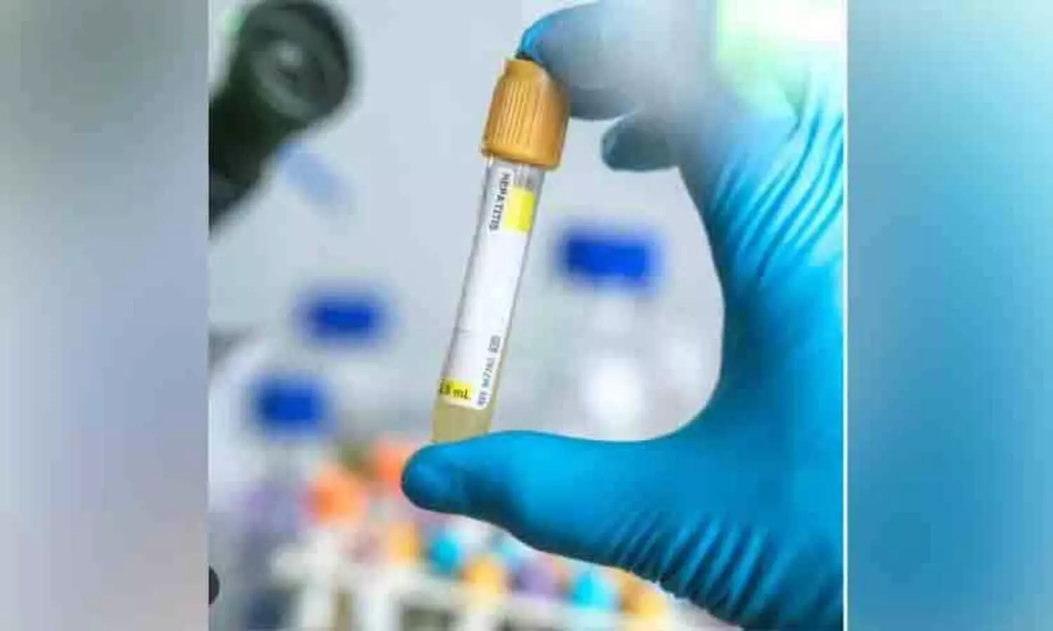 ഒ​മാ​നി​ൽ വി​വാ​ഹ​പൂ​ർ​വ മെ​ഡി​ക്ക​ൽ പ​രി​ശോ​ധ​ന നി​ർ​ബ​ന്ധം