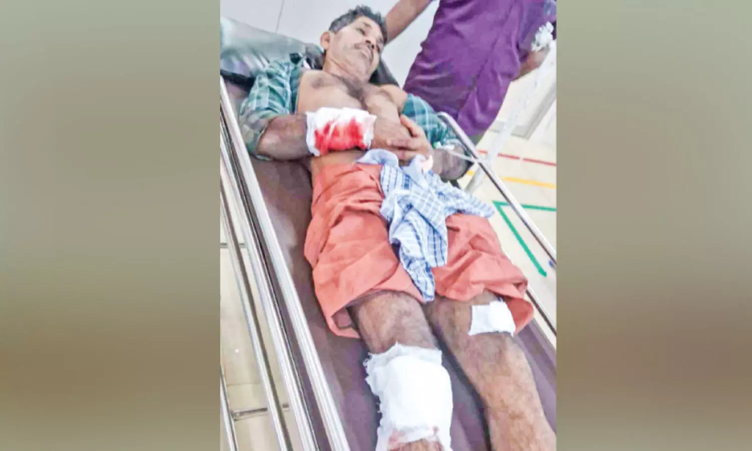 കാ​ട്ടു​പ​ന്നി ആ​ക്ര​മ​ണം; തെ​ങ്ങു​ക​യ​റ്റ തൊ​ഴി​ലാ​ളി​ക്ക് ഗു​രു​ത​ര പ​രി​ക്ക്