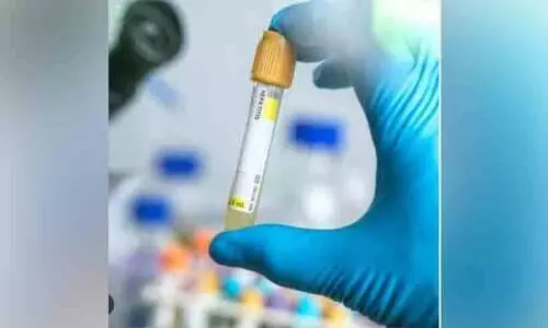 ഒ​മാ​നി​ൽ വി​വാ​ഹ​പൂ​ർ​വ മെ​ഡി​ക്ക​ൽ പ​രി​ശോ​ധ​ന നി​ർ​ബ​ന്ധം