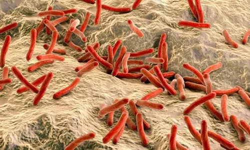 കുഷ്ഠരോഗം;  ഭവന സന്ദർശന കാമ്പയിൻ നാളെ മുതൽ