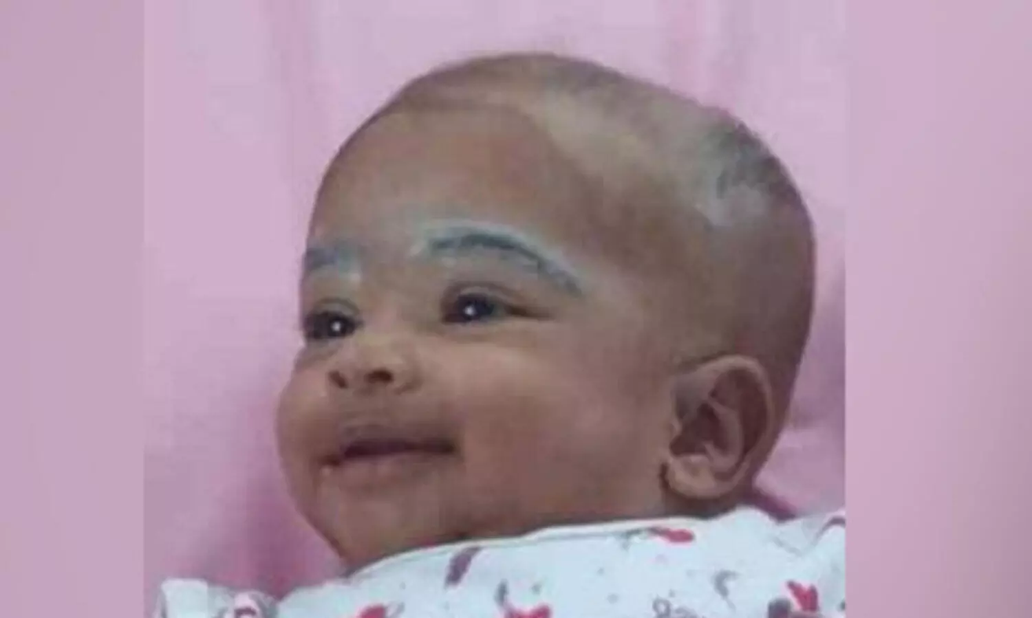 കോഴിക്കോട് മുലപ്പാൽ തൊണ്ടയിൽ കുടുങ്ങി അഞ്ചുമാസം പ്രായമായ കുഞ്ഞ് മരിച്ചു