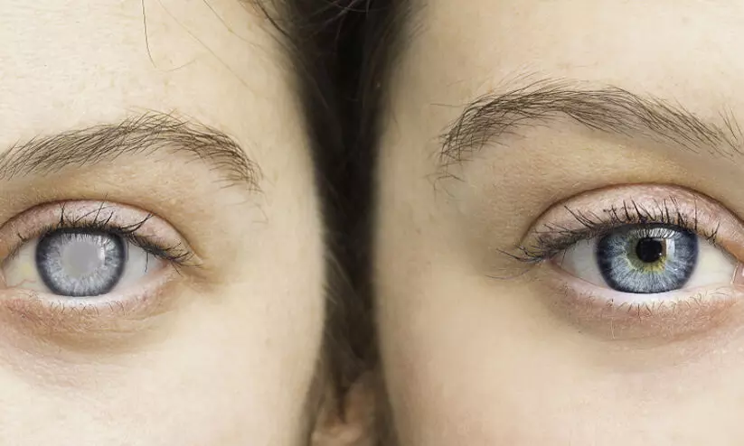 Early warning signs of glaucoma young adults often ignore Early warning signs of glaucoma young adults often ignore