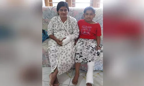 തെരുവുനായ് ആക്രമണം; സ്‌കൂട്ടറിൽനിന്ന് വീണ് അമ്മക്കും മകൾക്കും പരിക്ക്