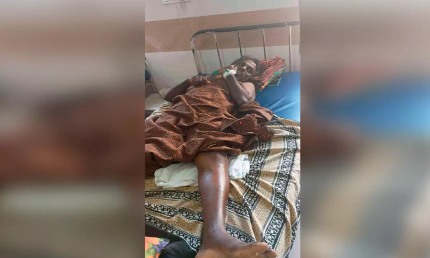 ബൈക്കിന് പിന്നിൽ മറ്റൊരു ബൈക്കിടിച്ച് മധ‍്യവയസ്കന് ഗുരുതര പരിക്ക്