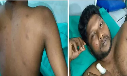 മ​ണ്ണ് ലോ​റി നാ​ട്ടു​കാ​ർ ത​ട​ഞ്ഞു: സം​ഘ​ർ​ഷ​ത്തി​ൽ ര​ണ്ടു​പേ​ർ​ക്ക് പ​രി​ക്ക്