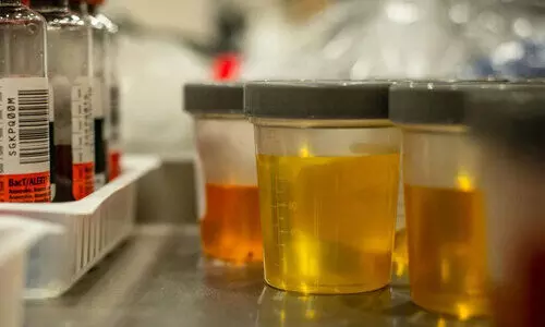 വൃക്കകൾ തകരാറിലാണെന്ന് മൂത്രം നൽകുന്ന സൂചനകൾ ഇവയാണ്...