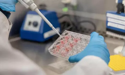 അർബുദ ചികിത്സയിൽ മുന്നേറ്റം; പ്രകാശാധിഷ്ഠിത നാനോ ടെക്നോളജി വികസിപ്പിച്ച് ന്യൂയോര്ക്ക് യൂനിവേഴ്സിറ്റി അബൂദബി ഗവേഷകർ അർബുദ ചികിത്സയിൽ മുന്നേറ്റം; പ്രകാശാധിഷ്ഠിത നാനോ ടെക്നോളജി വികസിപ്പിച്ച് ന്യൂയോര്ക്ക് യൂനിവേഴ്സിറ്റി അബൂദബി ഗവേഷകർ