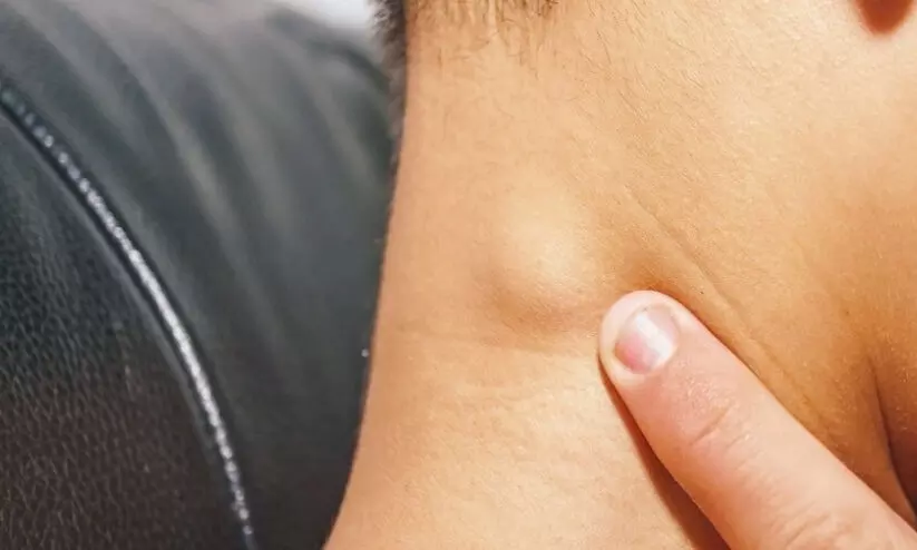 എല്ലാ മുഴകളും നീർവീക്കവും സാധാരണമാണോ? അപകടകാരികളായവയെ എങ്ങനെ തിരിച്ചറിയാം?