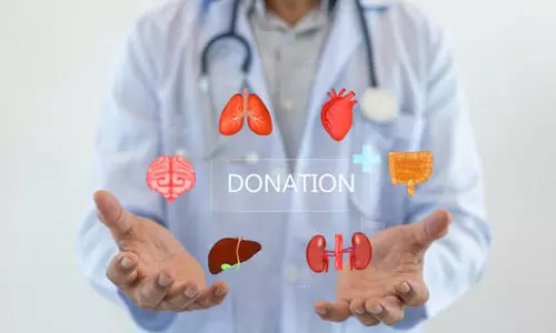 Representation Image