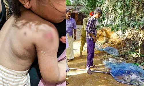 തെരുവുകളിൽ ഭീതി വിതച്ച് നായ്ക്കൾ