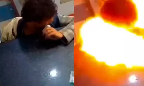 Young Boy Injured After Phone Battery Explodes In Mouth