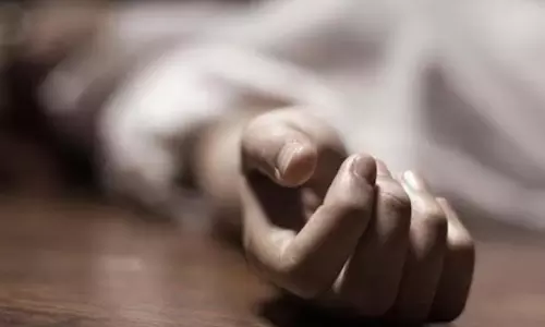 Representation Image