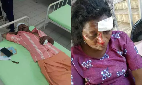 കാട്ടുപന്നിയുടെ അക്രമത്തിൽ ദമ്പതികൾക്ക് പരിക്ക്