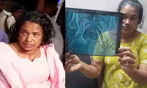 വയറിൽ കത്രിക കുടുങ്ങിയ ഉഷ അമൃത ആശുപത്രിയിൽ