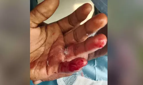 നാ​ലു പേ​രെ തെ​രു​വു​നാ​യ് ആ​ക്ര​മി​ച്ചു