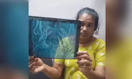 വയറ്റില്‍ കത്രിക കുടുങ്ങിയതില്‍ ഡോക്ടര്‍ ഷാഹിദക്ക് ക്ലീന്‍ ചിറ്റ്; വീഴ്ച സംഭവിച്ചിട്ടില്ലെന്ന് അന്വേഷണ റിപ്പോർട്ട്