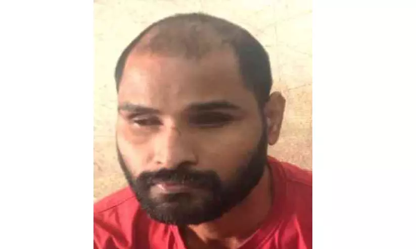 മുട്ടുവേദനക്ക് ചികിത്സ തേടി; ശസ്ത്രക്രിയ ചെയ്ത് കൃഷ്ണമണികൾ നീക്കി മുട്ടുവേദനക്ക് ചികിത്സ തേടി; ശസ്ത്രക്രിയ ചെയ്ത് കൃഷ്ണമണികൾ നീക്കി