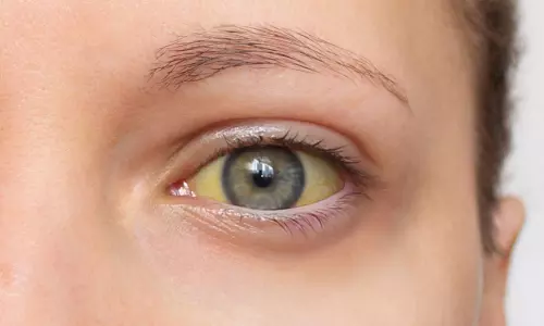 പന്തളത്ത് മഞ്ഞപ്പിത്തം