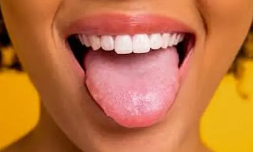 നാവ് നോക്കി മനസിലാക്കാം ഈ ആറ് രോഗ ലക്ഷണങ്ങൾ