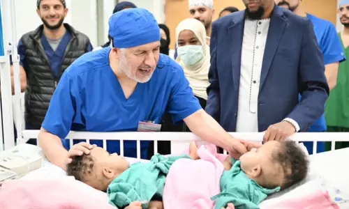 ശസ്ത്രക്രിയ വിജയകരം, സൊമാലിയൻ സയാമീസ് ഇരട്ടകൾ തമ്മിലകന്നു