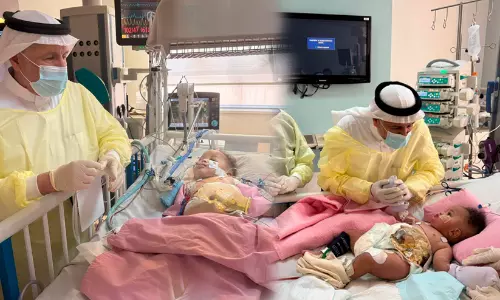 സൊമാലിയൻ സയാമീസ് ഇരട്ടകളുടെ ആരോഗ്യനില തൃപ്തികരം -ഡോ. അബ്​ദുല്ല അൽറബീഅ