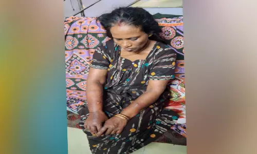 മധ്യവയസ്കക്ക് സൂര്യാതപമേറ്റു