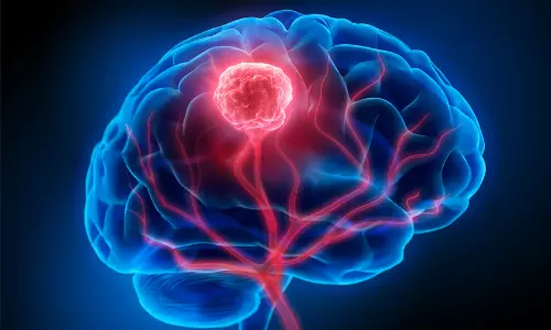 ബ്രെയിൻ ട്യൂമർ കേസുകൾ വർധിക്കുന്നു; ലക്ഷണങ്ങൾ അവഗണിക്കരുതെന്ന് ആരോഗ്യ വിദഗ്ധർ ബ്രെയിൻ ട്യൂമർ കേസുകൾ വർധിക്കുന്നു; ലക്ഷണങ്ങൾ അവഗണിക്കരുതെന്ന് ആരോഗ്യ വിദഗ്ധർ