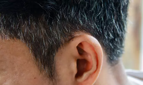 അകാലനര കൂട്ടുകാർക്കിടയിൽ പ്രശ്നമായോ..? വിദഗ്ധർ പറയുന്ന കാരണങ്ങളും പ്രതിവിധികളും