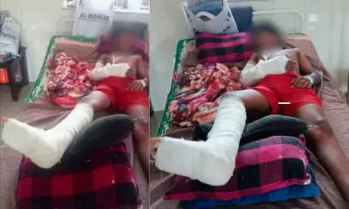 വീട്ടുമുറ്റത്ത് കളിക്കുന്നതിനിടെ കാട്ടുപന്നി ആക്രമണം; ആറാം ക്ലാസുകാരന് ഗുരുതര പരിക്ക് വീട്ടുമുറ്റത്ത് കളിക്കുന്നതിനിടെ കാട്ടുപന്നി ആക്രമണം; ആറാം ക്ലാസുകാരന് ഗുരുതര പരിക്ക്