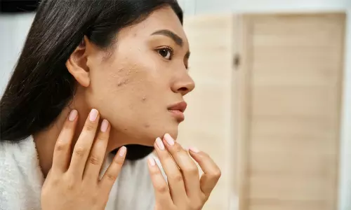 ഗർഭാശയ മുഴകളും പി.സി.ഒ.ഡിയും: ലക്ഷണങ്ങൾ കണ്ടാൽ അവഗണിക്കരുത്